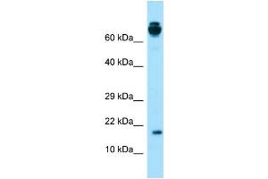 Western Blotting (WB) image for anti-Vitamin K-dependent protein C (PROC) (Middle Region) antibody (ABIN2774395) (PROC 抗体  (Middle Region))