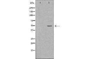 Western blot analysis of extracts of HeLa , using DRD1antibody. (Dopamine Receptor d1 抗体  (N-Term))