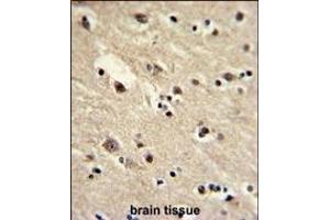 Immunohistochemistry (Paraffin-embedded Sections) (IHC (p)) image for anti-Eukaryotic Translation Elongation Factor 1 alpha 2 (EEF1A2) (AA 46-72) antibody (ABIN390520)