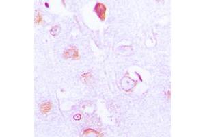 Immunohistochemical analysis of FXR2 staining in human brain formalin fixed paraffin embedded tissue section. (FXR2 抗体  (C-Term))