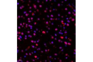 Immunofluorescence of paraffin embedded mouse Brain using RB1 (ABIN7075477) at dilution of 1:1400 (400x lens) (RBM45 抗体)
