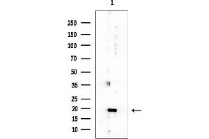 Western blot analysis of lysates from EC304 cells, using PPP1R14B Mouse Monoclonal Antibody at 1/1000 dilution.