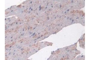 Immunohistochemistry (IHC) image for anti-N-Acetyltransferase 1 (Arylamine N-Acetyltransferase) (NAT1) (AA 9-254) antibody (ABIN7436222)