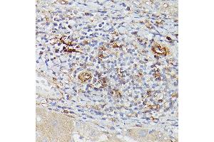 Immunohistochemistry of paraffin-embedded human liver using ENTPD1/CD39 Rabbit pAb (ABIN1679729, ABIN3018088, ABIN3018089 and ABIN6220354) at dilution of 1:25 (40x lens). (CD39 抗体  (AA 1-180))