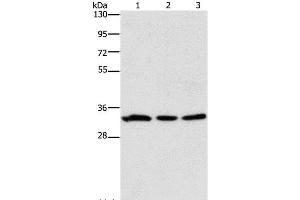 Western Blot analysis of 293T and Human colon cancer tissue, 231 cell using GPA33 Polyclonal Antibody at dilution of 1:600 (GPA33 抗体)