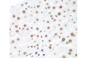 Immunohistochemistry of paraffin-embedded Mouse liver using Argonaute-2 Polyclonal Antibody at dilution of 1:100 (40x lens). (AGO2 抗体)