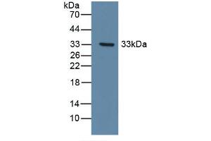 Detection of Recombinant DDR1, Human using Polyclonal Antibody to Discoidin Domain Receptor Family, Member 1 (DDR1) (DDR1 抗体  (AA 568-829))