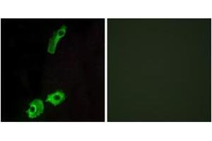 Immunofluorescence analysis of HeLa cells, using GPR151 Antibody. (GPR151 抗体  (AA 276-325))