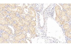 Detection of DNASEII in Human Kidney Tissue using Polyclonal Antibody to Deoxyribonuclease II (DNASEII) (Deoxyribonuclease II (AA 19-360) 抗体)
