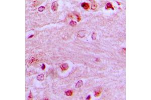 Immunohistochemical analysis of EZH1 staining in human brain formalin fixed paraffin embedded tissue section. (EZH1 抗体  (Center))