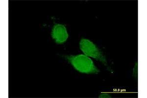 Immunofluorescence of purified MaxPab antibody to NCK1 on HeLa cell. (NCK1 抗体  (AA 1-377))