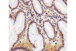 Immunohistochemistry (IHC) image for anti-RAC1 antibody (ABIN3032428)