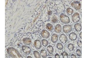 Image no. 1 for anti-Interleukin 37 (IL37) (AA 1-219) antibody (ABIN599218) (IL-37 抗体  (AA 1-219))