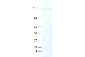 Validation with Western Blot