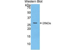 Western blot analysis of the recombinant protein. (iPLA2 抗体  (AA 481-702))