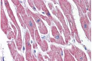 Immunohistochemistry (Formalin-fixed Paraffin-embedded Sections) (IHC (fp)) image for anti-ATP Synthase, H+ Transporting, Mitochondrial F1 Complex, epsilon Subunit (ATP5E) (AA 1-52) antibody (ABIN574212)
