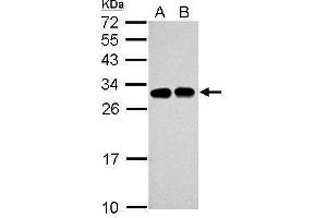 WB Image Sample (30 ug of whole cell lysate) A: Jurkat B: Raji 12% SDS PAGE antibody diluted at 1:5000 (SLC25A11 抗体)
