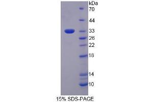 Image no. 1 for Eukaryotic Translation Initiation Factor 3, Subunit M (EIF3M) (AA 2-251) protein (His tag) (ABIN5665122) (Eukaryotic Translation Initiation Factor 3, Subunit M (EIF3M) (AA 2-251) protein (His tag))