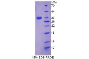 SDS-PAGE (SDS) image for Protein tyrosine Phosphatase, Receptor Type, H (PTPRH) (AA 844-1096) protein (His tag) (ABIN2126542)