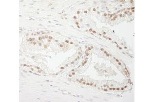 Immunohistochemistry (IHC) image for anti-Cleavage Stimulation Factor, 3' Pre-RNA, Subunit 3, 77kDa (CSTF3) (AA 667-717) antibody (ABIN7448498)