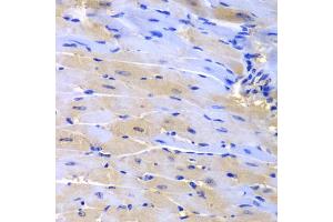 Immunohistochemistry of paraffin-embedded mouse heart using CUL2 antibody (ABIN5975808) at dilution of 1/200 (40x lens). (Cullin 2 抗体)