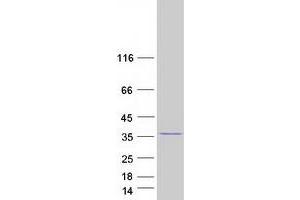 Western Blotting (WB) image for GTPase, IMAP Family Member 5 (GIMAP5) protein (Myc-DYKDDDDK Tag) (ABIN2721877)