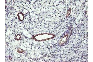 Image no. 2 for anti-Family with Sequence Similarity 84, Member B (FAM84B) antibody (ABIN1498212) (FAM84B 抗体)