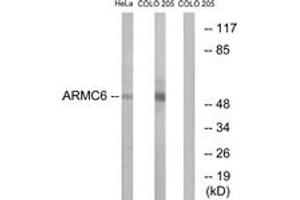 Western blot analysis of extracts from HeLa/COLO cells, using ARMC6 Antibody.