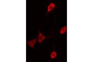 ABIN6276361 staining  A2780 cells by IF/ICC. (CDKN1B 抗体  (Internal Region))