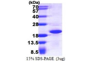 SDS-PAGE (SDS) image for CGRP Receptor Component (CRCP) (AA 1-148) protein (His tag) (ABIN667542) (CRCP Protein (AA 1-148) (His tag))