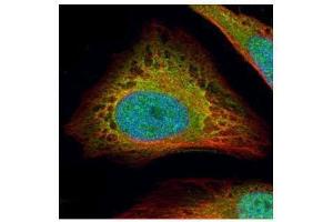 ICC/IF Image Confocal immunofluorescence analysis (Olympus FV10i) of paraformaldehyde-fixed HeLa, using Flightless I, antibody (Green) at 1:500 dilution. (Flightless I 抗体  (Internal Region))