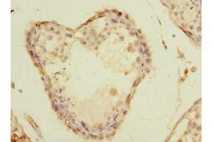 Immunohistochemistry of paraffin-embedded human testis tissue using ABIN7155918 at dilution of 1:100 (PLA2G16 抗体  (AA 1-132))