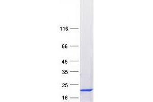 Western Blotting (WB) image for Tubulin Folding Cofactor A (TBCA) protein (Myc-DYKDDDDK Tag) (ABIN2733281)