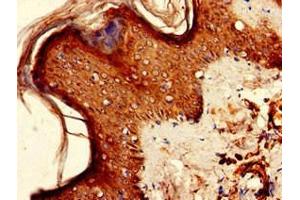 Immunohistochemistry of paraffin-embedded human skin tissue using ABIN7157511 at dilution of 1:100 (KIR2DS2 抗体  (AA 104-241))