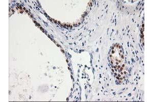 Immunohistochemical staining of paraffin-embedded Human prostate tissue using anti-SMS mouse monoclonal antibody. (SMS 抗体)