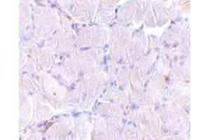 Immunohistochemical staining of human skeletal muscle tissue with 10 ug/mL SCARB2 polyclonal antibody . (SCARB2 抗体  (C-Term))