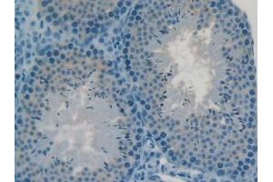 DAB staining on IHC-P; Samples: Mouse Testis Tissue (C2CD3 抗体  (AA 2051-2323))