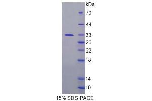 SDS-PAGE analysis of Human FPGT Protein. (FPGT 蛋白)