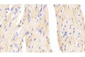 Detection of b2M in Mouse Cardiac Muscle Tissue using Polyclonal Antibody to Beta-2-Microglobulin (b2M) (beta-2 Microglobulin 抗体  (AA 22-119))