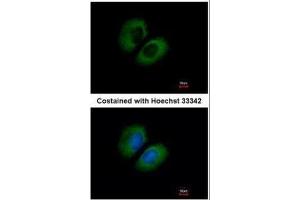 ICC/IF Image Immunofluorescence analysis of methanol-fixed A549, using CACNA1B, antibody at 1:500 dilution. (CACNA1B 抗体  (C-Term))