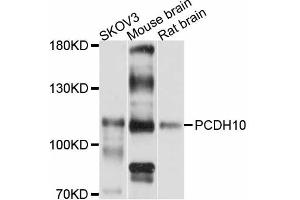 Western blot analysis of extracts of various cell lines, using PCDH10 antibody (ABIN5998466) at 1:3000 dilution. (PCDH10 抗体)