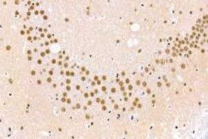 Immunohistochemistry analysis of paraffin-embedded mouse cerebral infarction using BAAT1 (ABIN7073502) at dilution of 1: 1000 (BAAT1 抗体)
