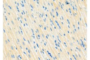 ABIN6263352 and ABIN6273268 at 1/100 staining Rat heart tissue by IHC-P.