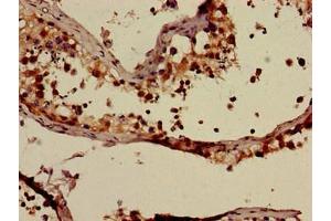 Immunohistochemistry (IHC) image for anti-ATP-Binding Cassette, Sub-Family C (CFTR/MRP), Member 9 (ABCC9) (AA 560-669) antibody (ABIN7144908)