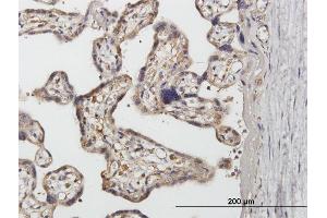 Immunoperoxidase of purified MaxPab antibody to SNX1 on formalin-fixed paraffin-embedded human placenta. (Sorting Nexin 1 抗体  (AA 1-522))
