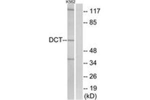 Western blot analysis of extracts from K562 cells, using DCT Antibody. (DCT 抗体  (AA 51-100))