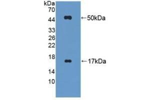 Detection of Recombinant FGL2, Mouse using Polyclonal Antibody to Fibrinogen Like Protein 2 (FGL2) (FGL2 抗体  (AA 20-432))