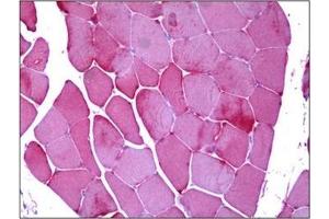 Immunohistochemistry (IHC) image for anti-Phosphorylase, Glycogen, Muscle (PYGM) antibody (ABIN952549) (PYGM 抗体)