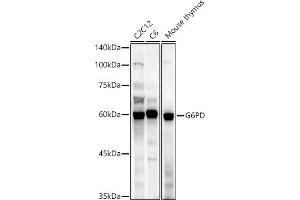 Western blot analysis of extracts of various cell lines, using G6PD antibody (ABIN3022094, ABIN3022095, ABIN3022096 and ABIN6218601) at 1:1000 dilution. (Glucose-6-Phosphate Dehydrogenase 抗体  (AA 246-545))