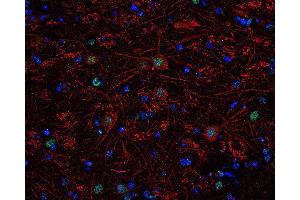 Indirect immunolabeling of PFA fixed, paraffin embedded mouse brain section with guinea pig anti-Tbr 1 (dilution 1 : 500; green) and rabbit anti-neurofilament H (, dilution 1 : 500; red).